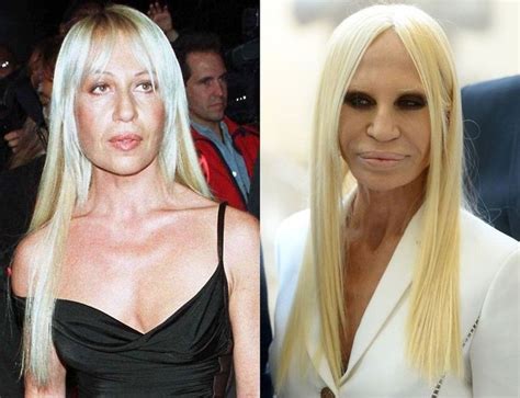 versace woman pladtic surgery|donatella Versace without plastic surgery.